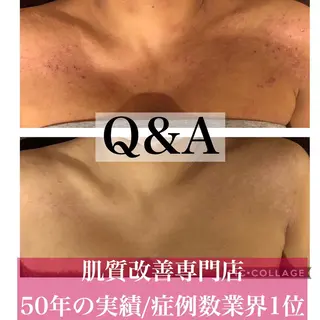 ミディアム カラー パーマ ヘアアレンジ メンズ キッズ ネイル マツエク・マツパ ニキビ・肌質改善専門 ♡人生が変わるサロンのエステ・リラクイメージ