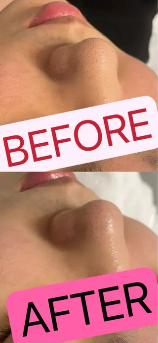 Queen Salonのエステ・リラクイメージ