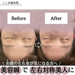 美容鍼/鍼灸 ここみ鍼灸院のエステ・リラクイメージ