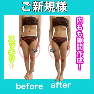 痩身/脱毛/ネイル HARUKAのエステ・リラクイメージ