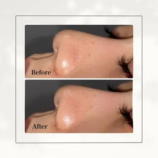 シミ・毛穴専門店 gracia 宇土店所属・シミ・毛穴専門店 /gracia 安藤のエステ・リラクイメージ