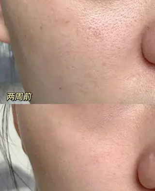 カラー 愛維美水光美肌専門店所属・愛維美水光美肌専門店 メンズレディースokのエステ・リラクイメージ