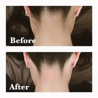 トータルサロンRuby所属・【医療提携】小顔 整体ハーブピーリングのその他イメージ