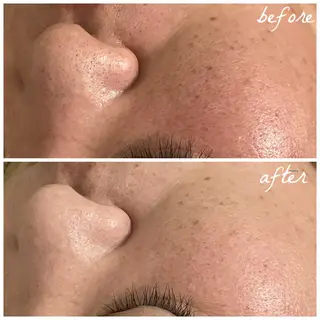 メンズ メナード岐阜茜部 杉浦のエステ・リラクイメージ