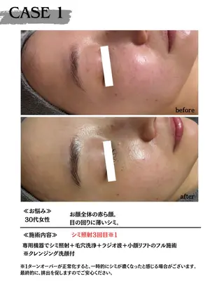 素肌育成・シミケア専門サロン美潤-miulu-所属・【医療提携サロン】 【シミケア専門】のエステ・リラクイメージ