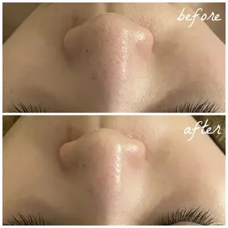 メンズ メナード岐阜茜部 杉浦のエステ・リラクイメージ