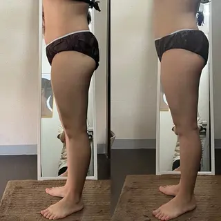 ハイパーナイフ専門店　Salon de COCO所属・Salon de COCOのエステ・リラクイメージ