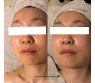 POLA THE BEAUTY 天王寺店所属・UEDA | POLA 天王寺のエステ・リラクイメージ