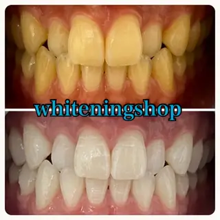 ホワイトニング ショップ吉祥寺店のエステ・リラクイメージ