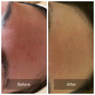 Empreinte (アンプラント)のエステ・リラクイメージ