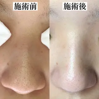 Soare(ソアレ)所属・【結果重視】 毛穴専門店のエステ・リラクイメージ