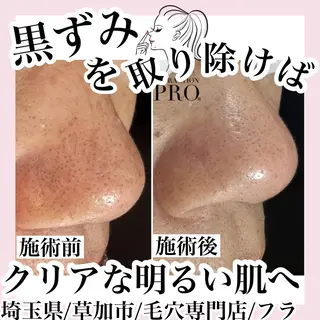 毛穴専門店hula 杉山智美のエステ・リラクイメージ