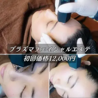 エステ.まつげ.小顔 眉毛.プラズマ.脱毛のマツエク・マツパデザイン