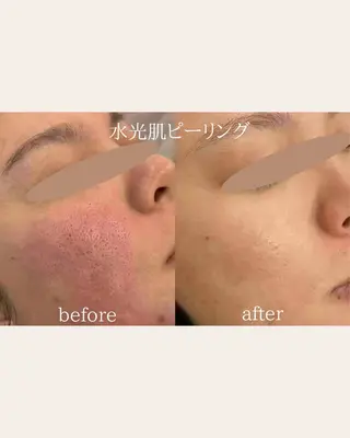 美腸サロン🌺 腸もみ/小顔/リンパのエステ・リラクイメージ