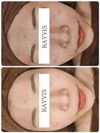 🖤RAYVIS🖤 青森店 豊島のエステ・リラクイメージ