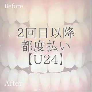 メンズ キッズ ホワイトニング ショップ多摩店のその他イメージ