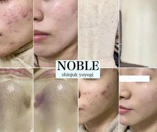 NOBLE 新宿南口店のエステ・リラクイメージ