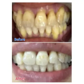 M渋谷店所属・M渋谷 ホワイトニングのその他イメージ