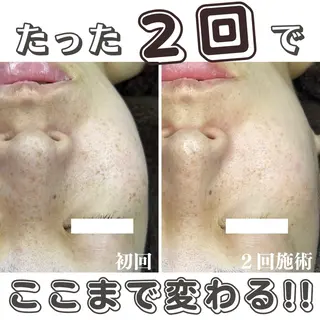 最新シミケアLily de pearlのエステ・リラクイメージ