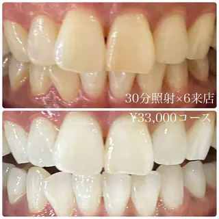 PLATINUM Beauty 横浜店所属・ホワイトニングルーム 横浜店のその他イメージ