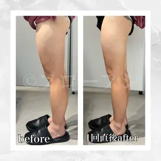 部分痩せ♥️小顔専門 MIKUのエステ・リラクイメージ