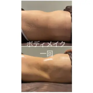 筋膜リリースエステ ESENCIAのエステ・リラクイメージ