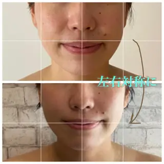 salon ace所属・【小顔矯正】 salonaceのエステ・リラクイメージ