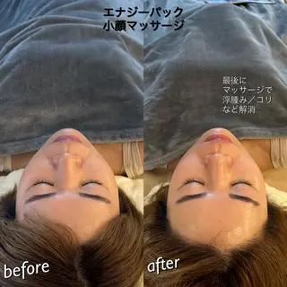 うなじ脱毛/美肌脱毛 LABELのエステ・リラクイメージ