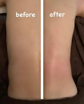 小顔・毛穴/ニキビ/ ハーブピーリング専門のエステ・リラクイメージ