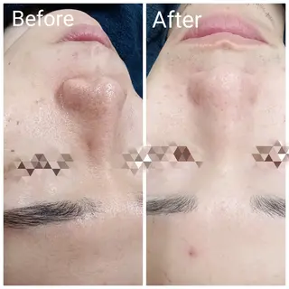 メンズ 肌質改善Beauty salon Renのエステ・リラクイメージ