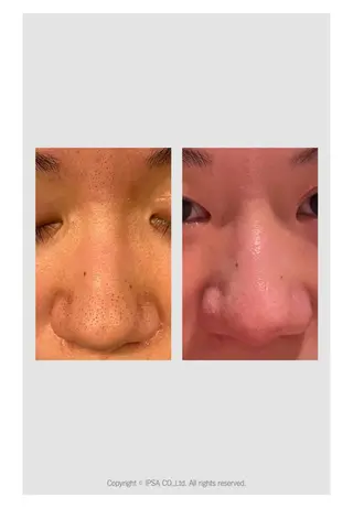 BACI STYLE所属・寧♡ 美肌小顔・ボディケアのエステ・リラクイメージ