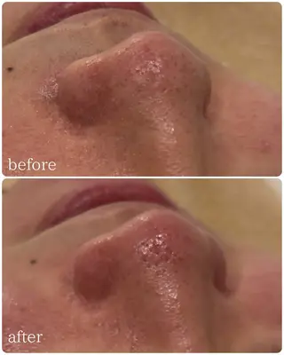 【Beauel】 あげはのエステ・リラクイメージ