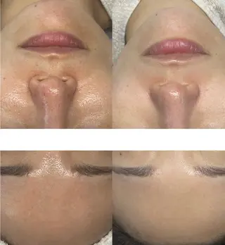 DahliaBeauty ダリアビューティー所属・DahliaBeau tyフェイシャル中村のエステ・リラクイメージ