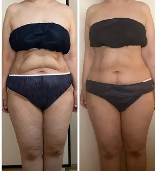 宮本 しおりのエステ・リラクイメージ