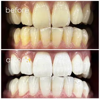 エクシア津駅前店所属・セルフホワイトニング エクシア津駅前店のその他イメージ