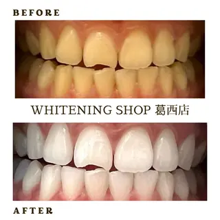 メンズ ホワイトニング ショップ葛西店のその他イメージ