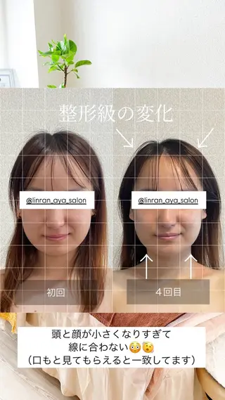 小顔集中型エステ 堺／大美野のエステ・リラクイメージ