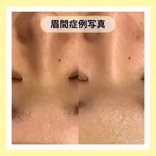 金山/脱毛/美肌 ULULUのエステ・リラクイメージ