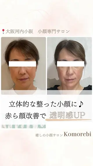 営業電話❌小顔サロン Komorebiのエステ・リラクイメージ