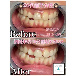 セルフホワイトニングビューティー三川店所属・中村 江梨香のその他イメージ