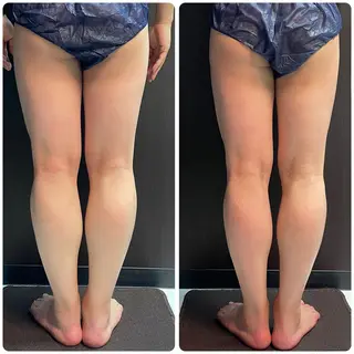 立体小顔×艶肌×美ボ ディ似合わせ施術 岡のエステ・リラクイメージ