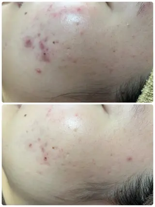 beautysalon LINO所属・平日昼間限定★ 全メニュ¥6600のエステ・リラクイメージ