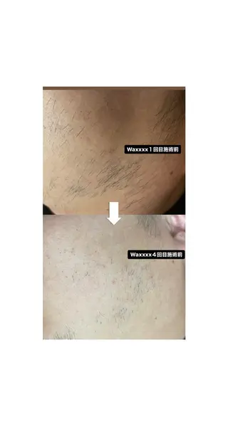 メンズ Epina 千葉店 【エピナ】のエステ・リラクイメージ