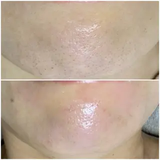 毛穴専門店RANA所属・毛穴専門店【各務原】 天使の毛穴のエステ・リラクイメージ