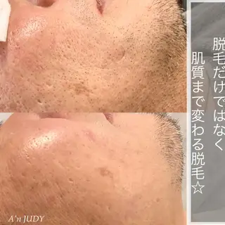 メンズ 脱毛&ビューティー A'nJUDYの眉毛・アイブロウイメージ