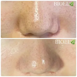 BeSkin藤沢店所属・ニキビ/肌質改善 BeSkin 藤沢店のエステ・リラクイメージ