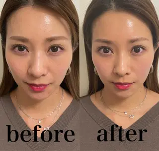 美容鍼灸サロン mahoroba院長のエステ・リラクイメージ