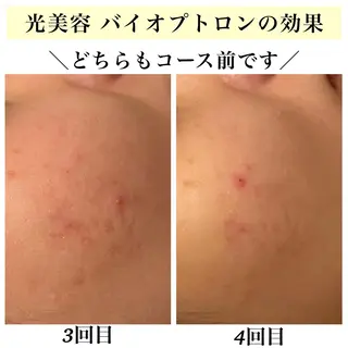 Bellesthe （ベルエステ）のエステ・リラクイメージ