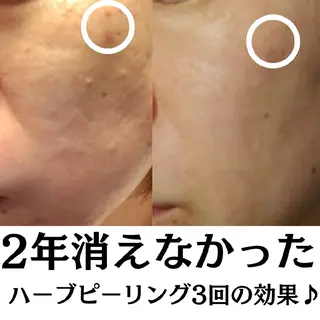 フェイシャル専門サロ ン　ERINのエステ・リラクイメージ