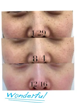 真下 美穂の眉毛・アイブロウイメージ